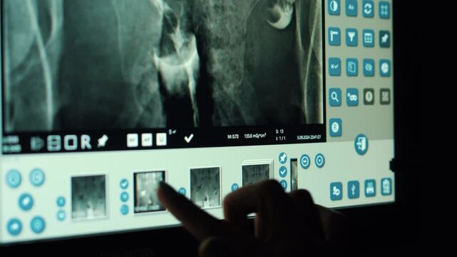 A specialist carefully examines HSG (hysterosalpingography) results on the touchscreen of a modern device. The detail of fingers focusing on analysis while switching between images.