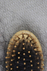 Women with hair loss dryness and frizziness