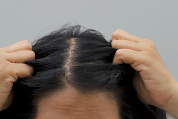 Woman has itchy scalp and hair loss