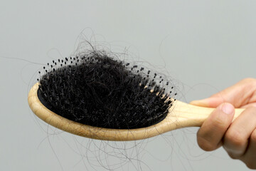 Woman with hair loss dryness and frizziness