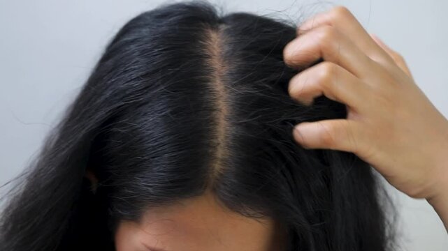 Woman has itchy scalp and hair loss