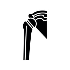 Artificial joint black glyph icon for digital and print projects.