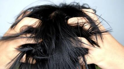 Close up of person scratching itchy scalp with both hands, showing signs of discomfort and irritation, highlighting hair and scalp health issues.