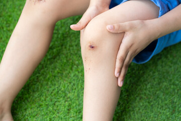 top view of wound of the knee in the boy at park