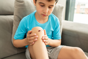 Close-up of young child boy bruised damaged injured knees after falling with old scars and fresh...