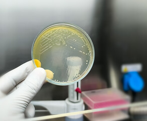 Colony of Burkholderia mallei, a Gram-negative, bipolar aerobic bacterium. B. pseudomallei