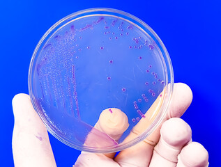 A microbiological culture Petri dish with a colonies of the pathogenic bacterium Escherichia coli...