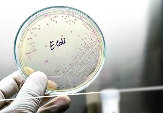 A microbiological culture Petri dish with a colonies of the pathogenic bacterium Escherichia coli (E. coli)