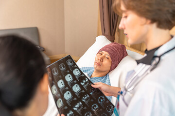 Asian man cancer patient visiting young female doctor for medical consultation in clinic. male patient struggling with cancer, healthcare. Medicine concept.Female doctor explaining xray to patient.