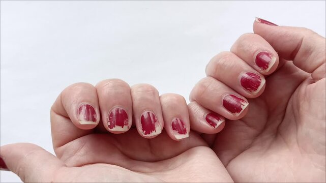 Worn red nail polish. Broken fingernails on a woman's hands. Unkempt nails.