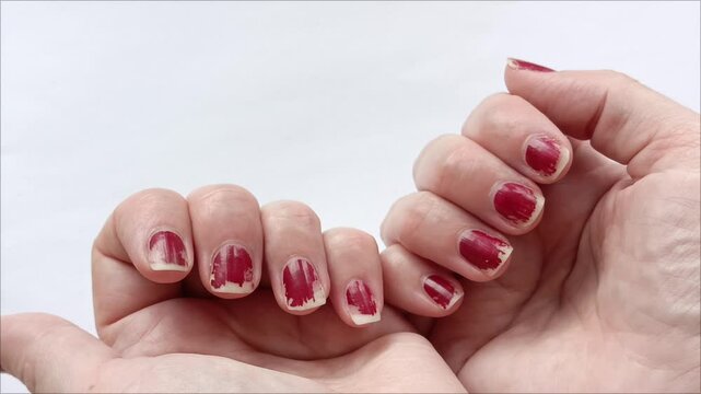 Broken fingernails of a woman. Chipped, worn red nail polish. Bad manicure.