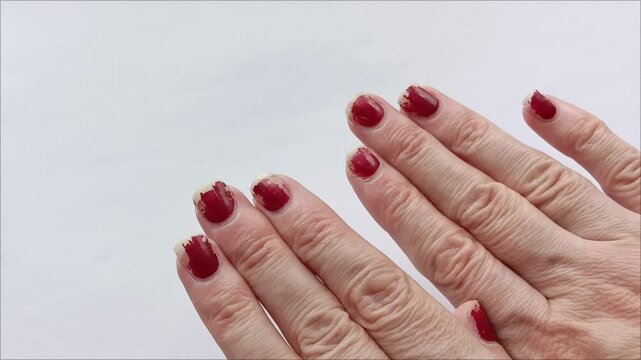 Broken fingernails of a woman. Chipped, worn red nail polish. Bad manicure.