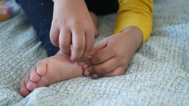 Child suffering itching skin on feet 