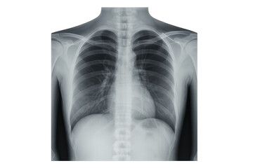 Radiographic image of healthy human thorax, showing lungs, heart, ribs, and bones, isolated on transparent background
