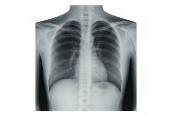 Radiographic image of healthy human thorax, showing lungs, heart, ribs, and bones, isolated on transparent background