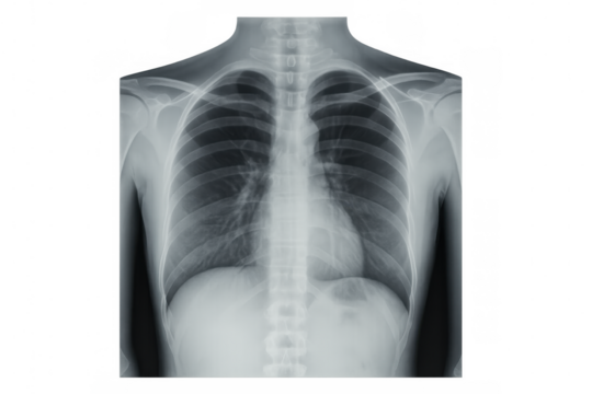 Radiographic image of healthy human thorax, showing lungs, heart, ribs, and bones, isolated on transparent background - Powered by Adobe
