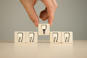 cubes with images of teeth and dental implant.
