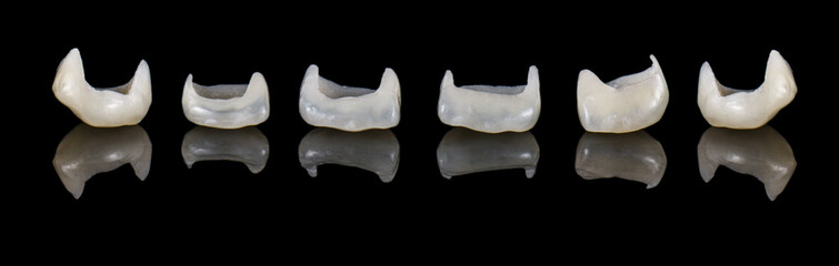 ceramic crowns and veneers