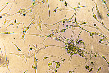 Glioblastoma cell culture.