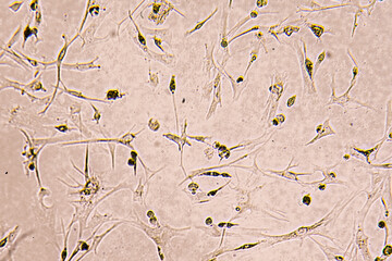 Glioblastoma cell culture.