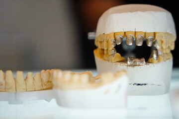 Different types of mouth guards with teeth.