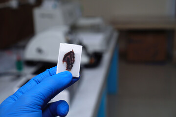 Scientist's hand wearing blue gloves holding a paraffin block of human tissue against a defocused...
