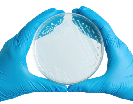 Two gloved hands hold a petri dish showing white bacterial colonies growing on an agar surface.