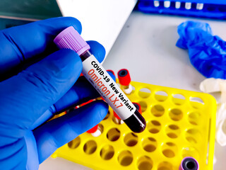 Covid-19 virus, blood sample for new omicron L.X.7 and XBB variant test. merged KS.1.1 and KP.3.3