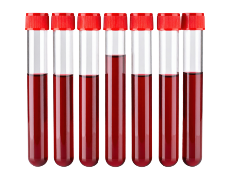 Seven test tubes filled with varying levels of dark red liquid and sealed with red caps are arranged side by side.