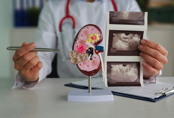 Doctor examining kidney model while reviewing ultrasound images