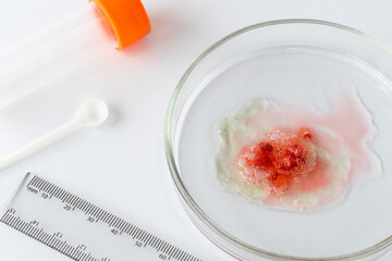  Laboratory Sample of Strawberry Alongside Essential Research Tools: An In-Depth Exploration of Food Spoilage and Safety Concerns in Microbiological Research Practices and Findings