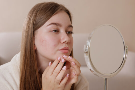 Teenage girl with acne examines her face in the mirror, highlighting skin imperfections and concerns about blemishes, skincare routine, and the challenges of adolescent skin health.