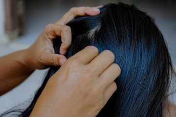 Fototapeta premium closeup of hands looking for lice in hair