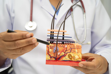 Hair transplant, Asian dermatologist doctor holding skin structure anatomy model for treatment in hospital.