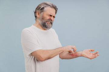 Senior man scratching itchy eczema on arm suffering from dermatitis