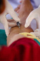 Close up nurse pricking needle syringe in the arm patient drawing blood sample for blood test , Health check