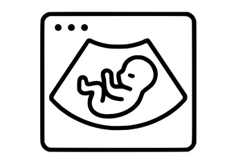 Line art illustration of a fetal ultrasound image displayed on a monitor, depicting a baby in a curled position.
