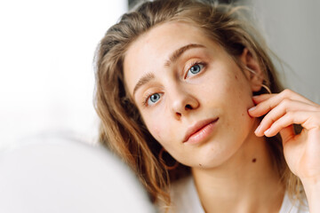 Naklejka premium Portrait of a beautiful woman touching her skin and examining a rash on her skin. Young woman looks at her reflection in the mirror. Cosmetology and beauty concept. Dermatology.