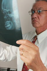 Doctor closely examining the X-Rays of one of his patients