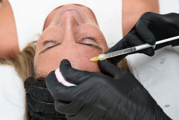 Dermatologist injecting hyaluronic acid into woman's forehead for wrinkle treatment
