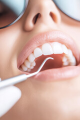 Fototapeta premium A person wearing protective eyewear is having their teeth examined with a dental tool. Dental care and oral hygiene