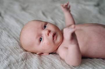 Newborn baby with acne on cheeks, common skin condition in infants