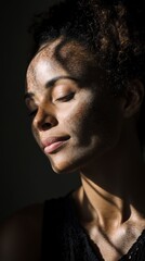 Obraz premium Beautiful portrait of a woman with vitiligo, soft shadows and highlights emphasizing skin texture