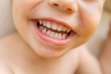 Close-up of a joyful baby's smile showing white teeth