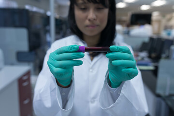 Asian female lab technician wearing lab coat examining blood collection tube with purple cap in lab
