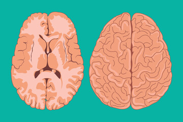 Detailed vector of human brain seen from superior and inferior perspectives.