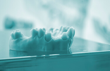 Prototype of human jaw gums and teeth printed on 3D printer from hardened rubber. Model of human lower gum with teeth created on 3D printer from hardened rubber under influence of ultraviolet light.