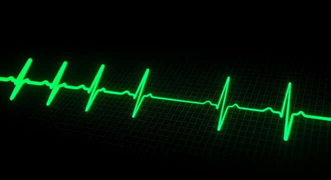 Heartbeat Monitor Displaying Normal Rhythm with Green Line on Grid