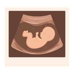 Vector cartoon image of ultrasound scan with baby. Pregnancy management concept. Element for your design