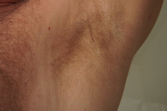 Raised Arm with Visible Armpit Hair. A close-up of a man's raised arm, clearly showing his light-colored armpit hair. The focus is on the armpit area, capturing the natural texture and color of the ha